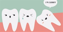 Mọc ngu lung tung và gây đau đớn mà chúng vẫn có tên là răng khôn là tại sao nhỉ?