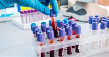 Có thể dự đoán trước cái chết thông qua xét nghiệm máu, độ chính xác tới 83%