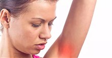 Ngứa nách có phải dấu hiệu cảnh báo ung thư?