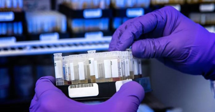 Thay đổi các chi tiết của bộ công cụ test